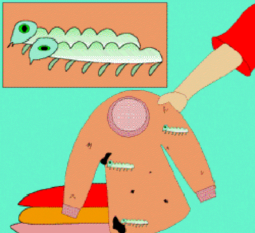 Why do Woollens Get Holes? [Illustration by Sudheer Nath]