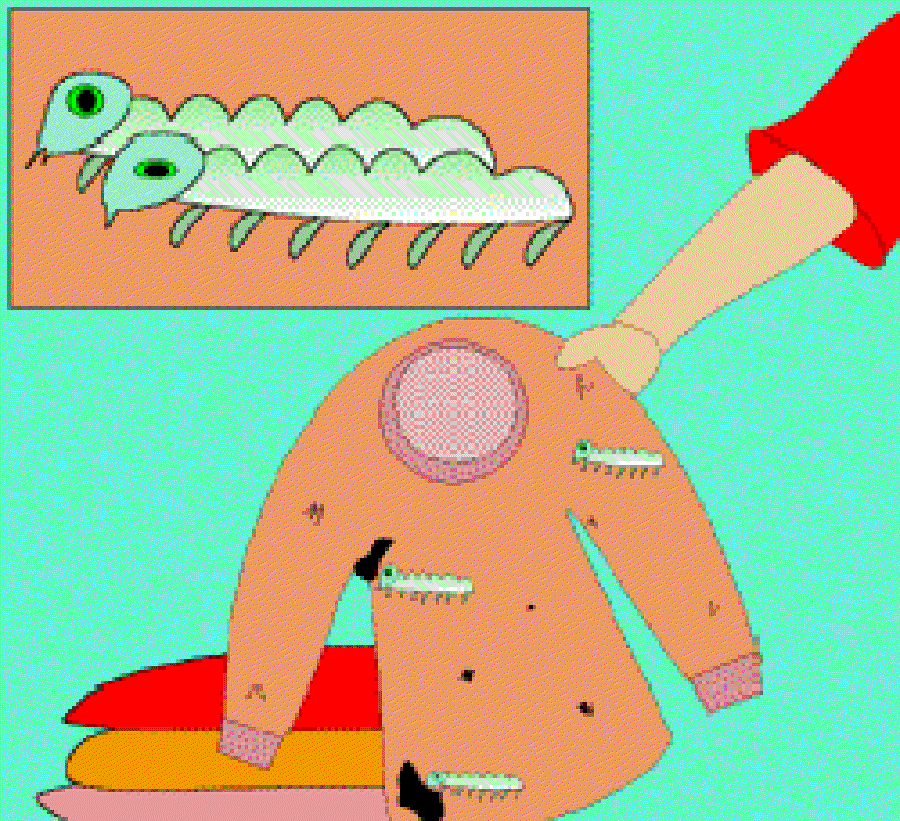 Why do Woollens Get Holes? [Illustration by Sudheer Nath]