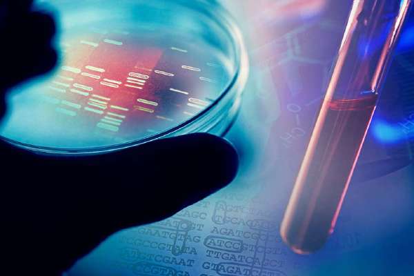 What is Ribotyping?