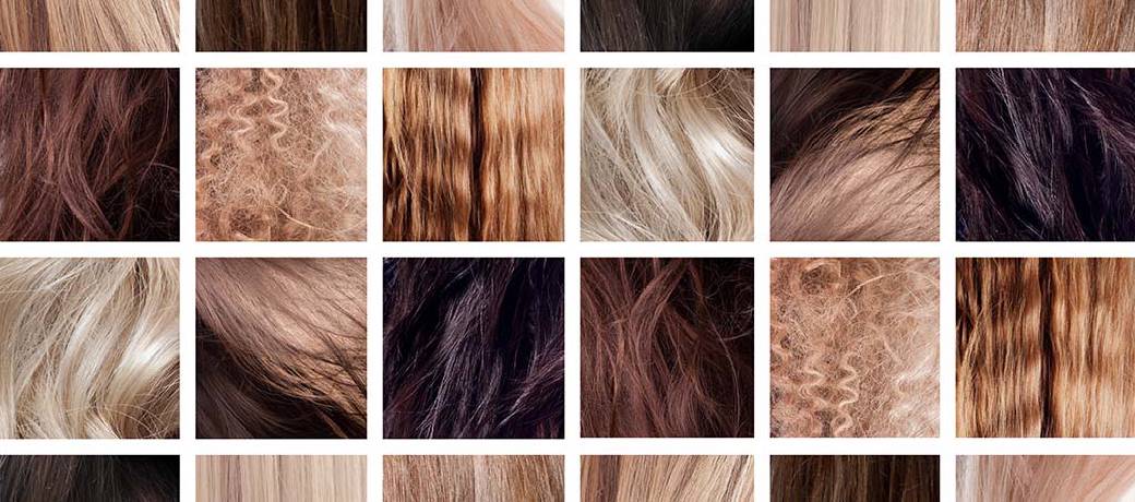 Why is Hair Today, Gone Tomorrow?