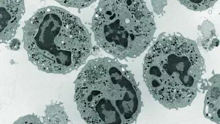 Illustration for What is Leukaemia?