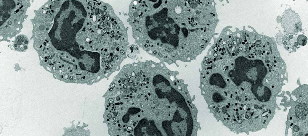 Illustration for What is Leukaemia?