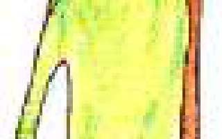 If The Tooth Be Told!...