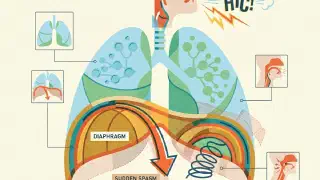 Illustration for Why do we Get Hiccups?